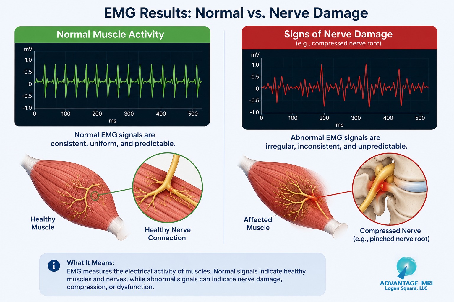 emg test on lower back